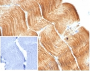 IHC staining of FFPE human skeletal muscle tissue with recombinant Alpha Actinin 2 antibody (clone ACTN2/7040R). Negative control inset: PBS instead of primary antibody to control for secondary binding. HIER: boil tissue sections in pH 9 10mM Tris with 1mM EDTA for 20 min and allow to cool before testing.