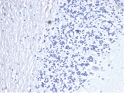 Negative control: IHC staining of FFPE human brain tissue using recombinant CD3 epsilon antibody (clone C3e/4653R) at 2ug/ml in PBS for 30min RT. HIER: boil tissue sections in pH 9 10mM Tris with 1mM EDTA for 20 min and allow to cool before testing.