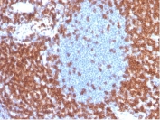 IHC staining of FFPE human tonsil tissue with recombinant CD3e antibody (clone CD3e/4653R) at 2ug/ml. HIER: boil tissue sections in pH 9 10mM Tris with 1mM EDTA for 20 min and allow to cool before testing.