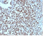 IHC staining of FFPE human tonsil tissue with CD27 antibody (clone LPFS2/4178). HIER: boil tissue sections in pH 9 10mM Tris with 1mM EDTA for 20 min and allow to cool before testing.