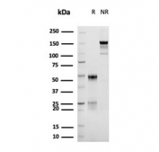 SDS-PAGE analysis of purified, BSA-free recombinant CD30 antibody (clone rKi-1/6913) as confirmation of integrity and purity.