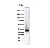 Western blot testing of human Raji cell lysate with recombinant CD38 antibody. Expected molecular weight: 34-46 kDa depending on glycosylation level.