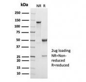 SDS-PAGE analysis of purified, BSA-free recombinant CD38 antibody (clone CD38/7017R) as confirmation of integrity and purity.