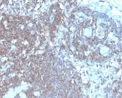 IHC staining of FFPE human lymph node tissue with CD48 antibody (clone CD48/4787). HIER: boil tissue sections in pH 9 10mM Tris with 1mM EDTA for 20 min and allow to cool before testing.