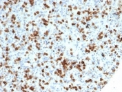IHC staining of FFPE human spleen tissue with recombinant CD59 antibody (clone MACIF/7021R). HIER: boil tissue sections in pH 9 10mM Tris with 1mM EDTA for 20 min and allow to cool before testing.