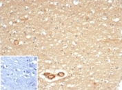 IHC staining of FFPE human cerebellum tissue with recombinant CD59 antibody (clone MACIF/7021R) at 2ug/ml. Cytoplasmic and membranous staining observed. Negative control inset: PBS used instead of primary antibody to control for secondary Ab binding. HIER: boil tissue sections in pH 9 10mM Tris with 1mM EDTA for 20 min and allow to cool before testing.