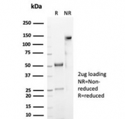 SDS-PAGE analysis of purified, BSA-free recombinant CD59 antibody (clone MACIF/7021R) as confirmation of integrity and purity.