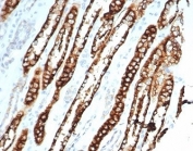 IHC staining of FFPE human kidney tissue with recombinant Cadherin 16 antibody (clone CHD16/7027R) at 2ug/ml in PBS for 30min RT. HIER: boil tissue sections in pH 9 10mM Tris with 1mM EDTA for 20 min and allow to cool before testing.