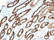IHC staining of FFPE human kidney tissue with recombinant Cadherin 16 antibody (clone CDH16/7027R). HIER: boil tissue sections in pH 9 10mM Tris with 1mM EDTA for 20 min and allow to cool before testing.