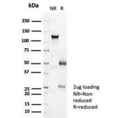 SDS-PAGE analysis of purified, BSA-free recombinant Cadherin 16 antibody (clone CDH16/7027R) as confirmation of integrity and purity.