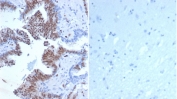 Left: IHC staining of FFPE human prostate tissue tissue with Transcriptional regulator ERG antibody (clone rERG/6843) at 2ug/ml. Right: Negative control staining of FFPE human brain tissue using Transcriptional regulator ERG antibody (clone rERG/6483) at 2ug/ml. HIER: boil tissue sections in pH 9 10mM Tris with 1mM EDTA for 20 min and allow to cool before testing.