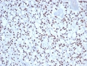 IHC staining of FFPE human kidney tissue with Nucleolin antibody (clone NCL/7338). HIER: boil tissue sections in pH 9 10mM Tris with 1mM EDTA for 20 min and allow to cool before testing.