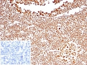 IHC staining of FFPE human tonsil tissue with Nucleolin antibody (clone NCL/7338). Negative control inset: PBS instead of primary antibody to control for secondary binding. HIER: boil tissue sections in pH 9 10mM Tris with 1mM EDTA for 20 min and allow to cool before testing.