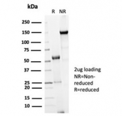 SDS-PAGE analysis of purified, BSA-free recombinant Cdc20 antibody (clone CDC20/7026R) as confirmation of integrity and purity.