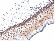 IHC staining of FFPE human cervix tissue with NME1 antibody (clone NME1/2737). HIER: boil tissue sections in pH 9 10mM Tris with 1mM EDTA for 20 min and allow to cool before testing.