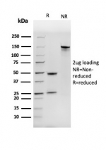 SDS-PAGE analysis of purified, BSA-free NME1 antibody (clone NME1/2737) as confirmation of integrity and purity.