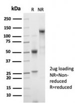 SDS-PAGE analysis of purified, BSA-free recombinant B2M antibody (clone B2M/7013R) as confirmation of integrity and purity.
