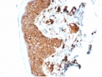 IHC staining of FFPE human skin with recombinant B2M antibody (clone B2M/7013R). HIER: boil tissue sections in pH 9 10mM Tris with 1mM EDTA for 20 min and allow to cool before testing.