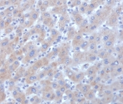 IHC staining of FFPE human liver tissue with Alpha-1-Antichymotrypsin antibody (clone SERPINA3/4185). HIER: boil tissue sections in pH 9 10mM Tris with 1mM EDTA for 20 min and allow to cool before testing.