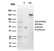 SDS-PAGE analysis of purified, BSA-free CD20 antibody (clone MS4A1/4655) as confirmation of integrity and purity.