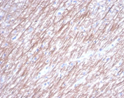 Beta Tubulin Antibody Brain IHC. Immunohistochemical analysis of Beta III tubulin (TUBB3) in formalin-fixed, paraffin-embedded human brain tissue using Beta Tubulin antibody clone TUBB3/7089R. Strong cytoplasmic staining is observed in neurons and neuropil, consistent with the localization of TUBB3 within neuronal microtubules. The staining pattern highlights neuronal processes and supports its use as a neural marker.
