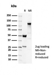 SDS-PAGE analysis of purified, BSA-free recombinant Beta Tubulin antibody (clone TUBB3/7089R) as confirmation of integrity and purity.