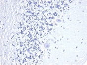 Negative control: IHC staining of FFPE human brain tissue using recombinant CD3e antibody (clone C3e/4652R) at 2ug/ml in PBS for 30min RT. HIER: boil tissue sections in pH 9 10mM Tris with 1mM EDTA for 20 min and allow to cool before testing.