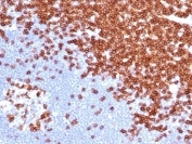 IHC staining of FFPE human lymph node tissue with recombinant CD3e antibody (clone C3e/4652R). HIER: boil tissue sections in pH 9 10mM Tris with 1mM EDTA for 20 min and allow to cool before testing.