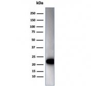 Western blot testing of human Jurkat cell lysate using recombinant CD3e antibody (clone C3e/4652R). Predicted molecular weight ~23 kDa.