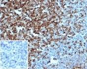 IHC staining of FFPE human tonsil tissue with recombinant CD2 antibody (clone LFA2/3417R). Negative control inset: PBS instead of primary antibody to control for secondary binding. HIER: boil tissue sections in pH 9 10mM Tris with 1mM EDTA for 20 min and allow to cool before testing.