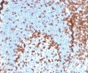 IHC staining of FFPE human tonsil tissue with recombinant CD2 antibody (clone LFA2/3417R). HIER: boil tissue sections in pH 9 10mM Tris with 1mM EDTA for 20 min and allow to cool before testing.