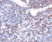 IHC staining of FFPE human lymph node tissue with recombinant CD2 antibody (clone LFA2/3417R). HIER: boil tissue sections in pH 9 10mM Tris with 1mM EDTA for 20 min and allow to cool before testing.