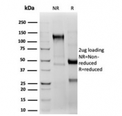 SDS-PAGE analysis of purified, BSA-free recombinant CD2 antibody (clone LFA2/3417R) as confirmation of integrity and purity.