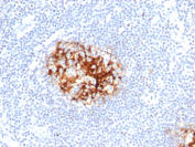 CD23 Antibody Lymph Node IHC. Immunohistochemistry analysis of FFPE human lymph node tissue stained with CD23 antibody clone FCER2/4918. Follicular dendritic cell networks and associated B-cell regions demonstrate strong membranous and cytoplasmic HRP-DAB brown staining for Low-affinity immunoglobulin epsilon Fc receptor / FCER2/CD23, consistent with the established expression pattern of CD23 within germinal center-associated immune cell populations. Hematoxylin counterstain highlights nuclei in blue. HIER: Tris/EDTA, pH9.0, 45 min. Secondary detection: HRP-polymer, 30 min. DAB development: 5 min.
