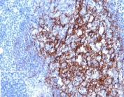 IHC staining of FFPE human tonsil tissue with CD23 antibody (clone FCER2/4918) at 2ug/ml in PBS for 30min RT. Negative control inset: PBS used instead of primary antibody to control for secondary Ab binding. HIER: boil tissue sections in pH 9 10mM Tris with 1mM EDTA for 20 min and allow to cool before testing.