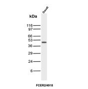 CD23 Antibody Daudi WB. Western blot analysis of Daudi cell lysate using CD23 antibody clone FCER2/4918. A distinct band is detected at approximately 45 kDa, consistent with the predicted molecular weight of Low-affinity immunoglobulin epsilon Fc receptor / FCER2/CD23. The observed expression pattern is consistent with the known presence of CD23 in B-cell lineage cells and its role in IgE receptor signaling, antigen presentation, and regulation of adaptive immune responses.