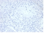Negative control: IHC staining of FFPE human testis tissue with recombinant ALPP antibody (clone rALP/870) at 2ug/ml in PBS for 30min RT. HIER: boil tissue sections in pH 9 10mM Tris with 1mM EDTA for 20 min and allow to cool before testing.
