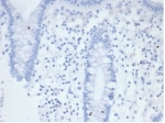 Negative control: IHC staining of FFPE human colon tissue with recombinant ALPP antibody (clone rALP/870) at 2ug/ml in PBS for 30min RT. HIER: boil tissue sections in pH 9 10mM Tris with 1mM EDTA for 20 min and allow to cool before testing.