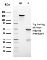 SDS-PAGE analysis of purified, BSA-free recombinant ALPP antibody (clone rALP/870) as confirmation of integrity and purity.