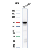 ALPP Antibody Placenta WB. Western blot analysis of human placenta tissue lysate using ALPP Antibody / Placental Alkaline Phosphatase Antibody (clone rALP/870) detects a strong band at approximately 68-70 kDa, consistent with the expected apparent molecular weight range of placental alkaline phosphatase / ALPP. Although the predicted molecular weight of ALPP is lower, the protein is commonly observed at higher apparent molecular weights due to extensive glycosylation and post-translational modification characteristic of this membrane-associated alkaline phosphatase family member.