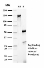 SDS-PAGE analysis of purified, BSA-free recombinant MSH6 antibody (clone MSH6/7065R) as confirmation of integrity and purity.