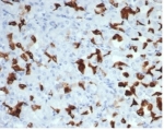 IHC staining of FFPE human salivary gland tissue with recombinant MSH6 antibody (clone MSH6/7065R). HIER: boil tissue sections in pH 9 10mM Tris with 1mM EDTA for 20 min and allow to cool before testing.