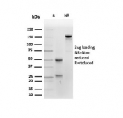 SDS-PAGE analysis of purified, BSA-free ALPP antibody (clone ALPP/4109) as confirmation of integrity and purity.