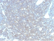 IHC staining of FFPE human lymph node tissue with CD48 antibody (clone CD48/4783) at 2ug/ml. HIER: boil tissue sections in pH 9 10mM Tris with 1mM EDTA for 20 min and allow to cool before testing.