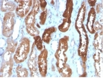 IHC staining of FFPE human kidney tissue with FABP3 antibody (clone FABP3/3430) HIER: boil tissue sections in pH 9 10mM Tris with 1mM EDTA for 20 min and allow to cool before testing.