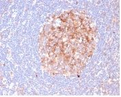 IHC staining of FFPE human lymph node tissue with recombinant CD86 antibody (clone C86/6500R) at 2ug/ml in PBS for 30min RT. Staining of cell surface is observed. HIER: boil tissue sections in pH 9 10mM Tris with 1mM EDTA for 20 min and allow to cool before testing.