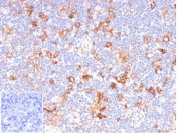 IHC staining of FFPE human lymph node tissue with recombinant CD86 antibody (clone C86/6500R). Negative control inset: PBS used instead of primary antibody to control for secondary Ab binding. HIER: boil tissue sections in pH 9 10mM Tris with 1mM EDTA for 20 min and allow to cool before testing.