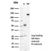 SDS-PAGE analysis of purified, BSA-free recombinant CDH16 antibody (clone CDH16/7028R) as confirmation of integrity and purity.