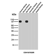 CDH16 Antibody Multi-Species Kidney WB. Western blot analysis of Cadherin-16 / CDH16 expression across kidney tissue lysates from multiple species using CDH16 antibody clone CDH16/7028R. Lane 1: human kidney lysate, Lane 2: mouse kidney lysate, Lane 3: rat kidney lysate, Lane 4: hamster kidney lysate, Lane 5: guinea pig kidney lysate, Lane 6: rabbit kidney lysate. Bands are detected at approximately 95-110 kDa in human and rat kidney lysates, consistent with the predicted molecular weight of Cadherin-16 (CDH16), with the slightly higher apparent migration reflecting glycosylation of this kidney-restricted adhesion protein. Minimal or no detectable signal is observed in mouse, hamster, guinea pig, and rabbit samples under these conditions, indicating selective species reactivity.