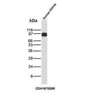 CDH16 Antibody Kidney Tissue WB. Western blot analysis of Cadherin-16 / CDH16 expression in human kidney tissue lysate using CDH16 antibody clone CDH16/7028R. Lane 1: human kidney lysate. A band is detected at approximately 95â110 kDa, consistent with the predicted molecular weight of Cadherin-16 (CDH16), with the slightly higher apparent migration reflecting glycosylation of this kidney-restricted adhesion protein. The strong signal in kidney tissue supports detection of CDH16 in renal epithelial cells and aligns with its role as a kidney-specific marker.